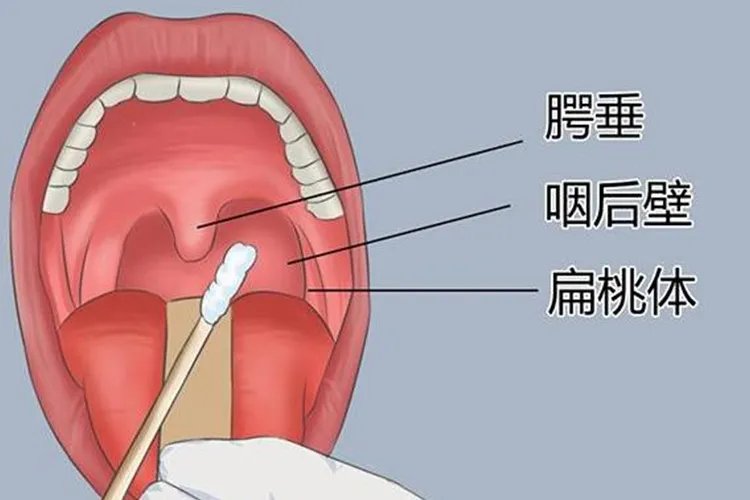 测核酸测哪个部位