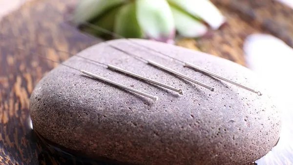 针灸治疗近视眼有用吗