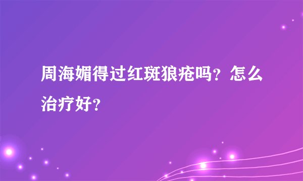 周海媚得过红斑狼疮吗？怎么治疗好？