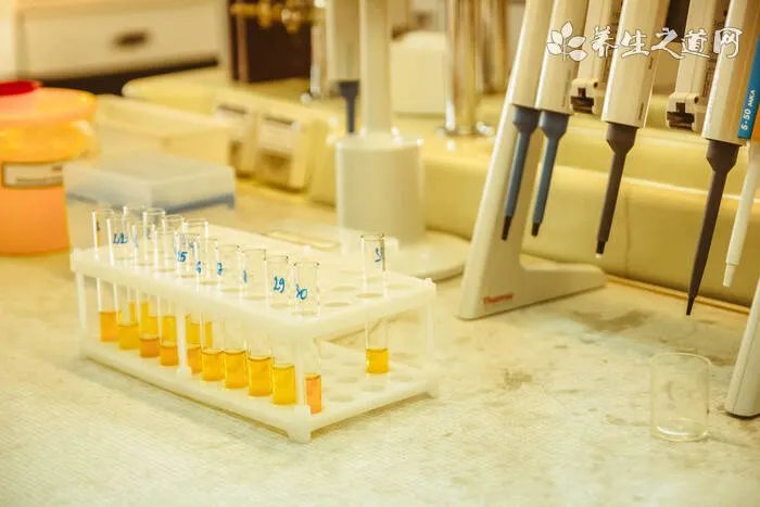 冬季吃什么补肾 七款食谱补肾最有效