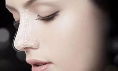 北京鼻头缩小多少钱