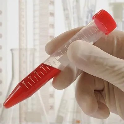 平均红细胞体积是什么