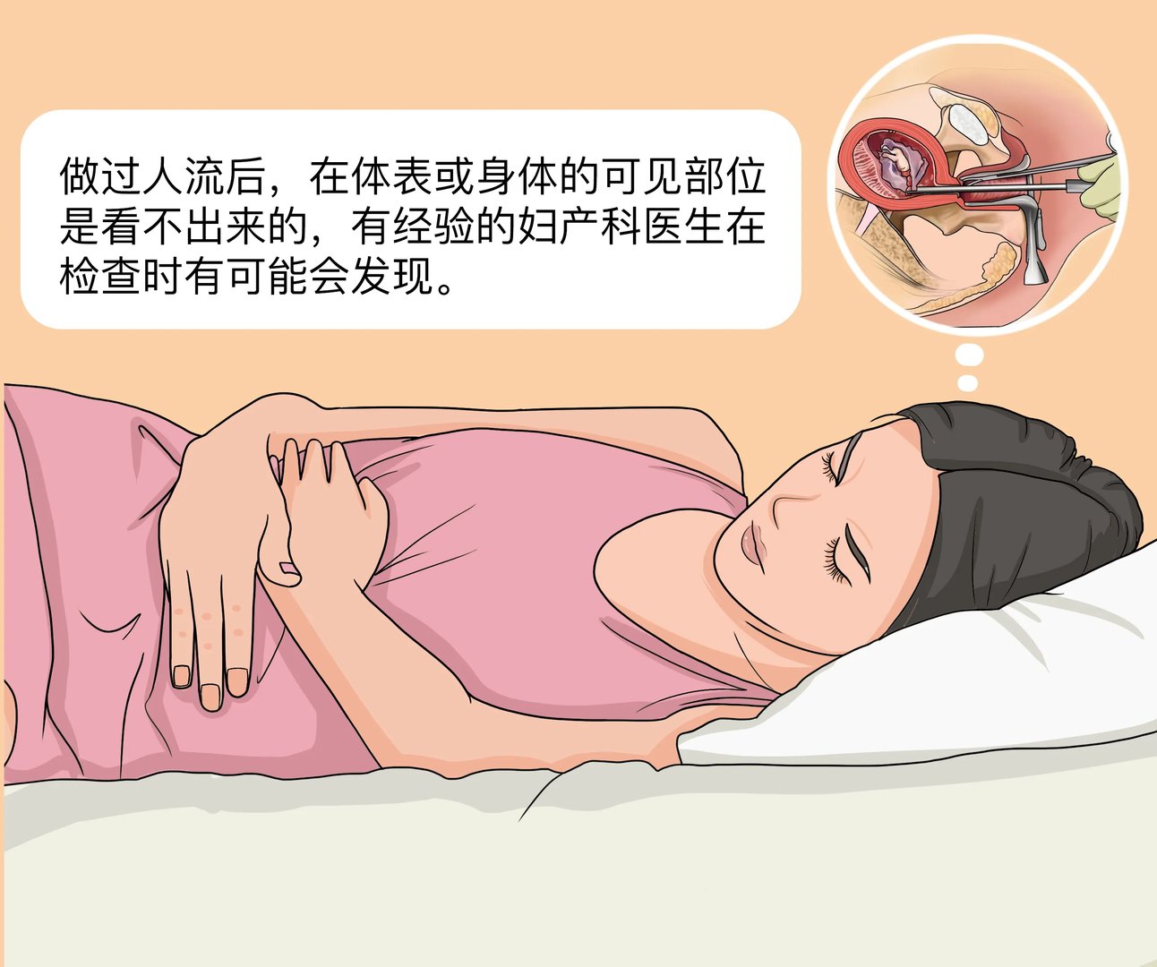 做过人流可以看出来吗