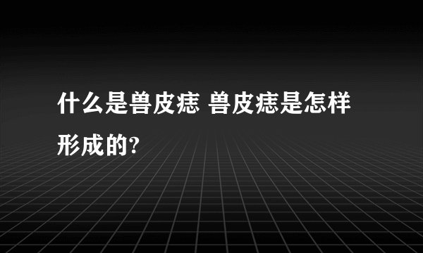 什么是兽皮痣 兽皮痣是怎样形成的?