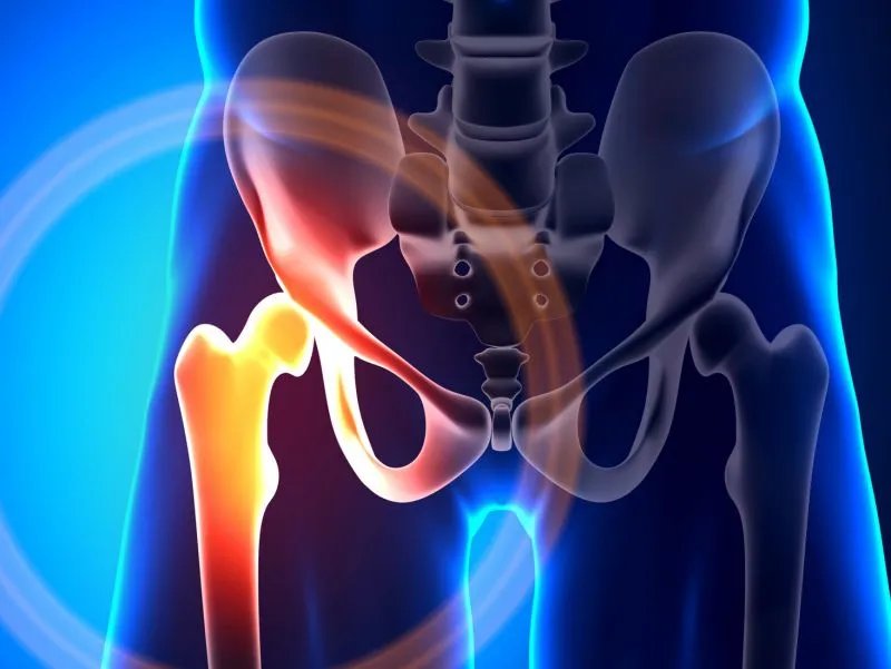 大骨节病的特征