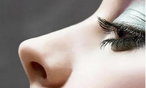 北京玻尿酸隆鼻要多少钱