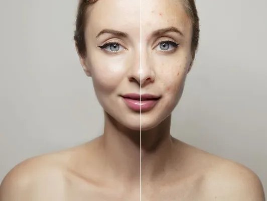 肌肤补水日常护理