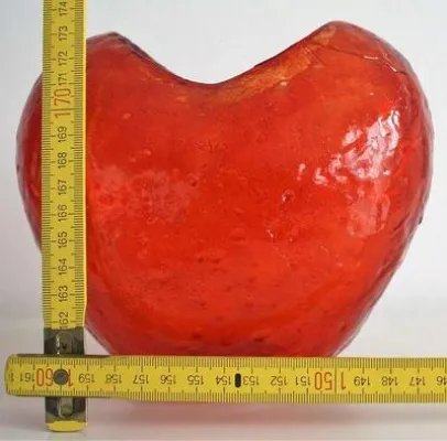 房室传导阻滞是什么意思