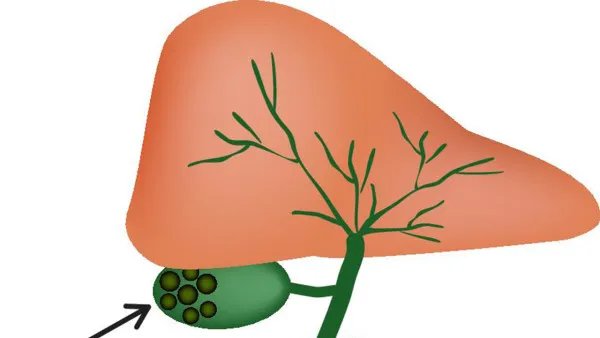 肝脏不好的症状