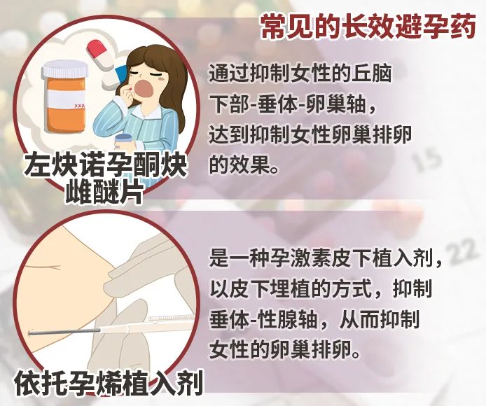 长效避孕药有哪些