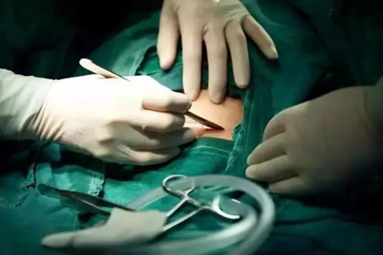 剖腹产7层全过程图片