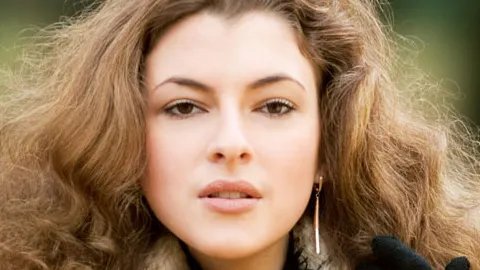 发际线植发如何