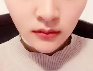 尖下颌角整形多少钱