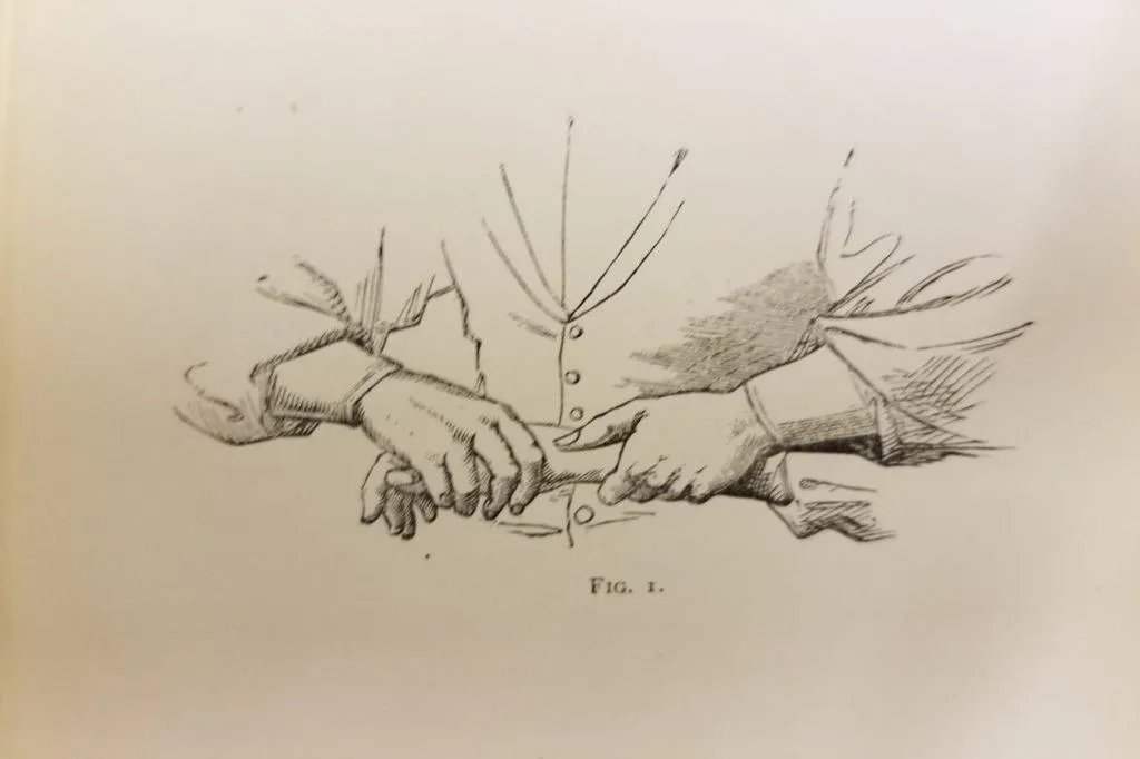 正骨手法图图解