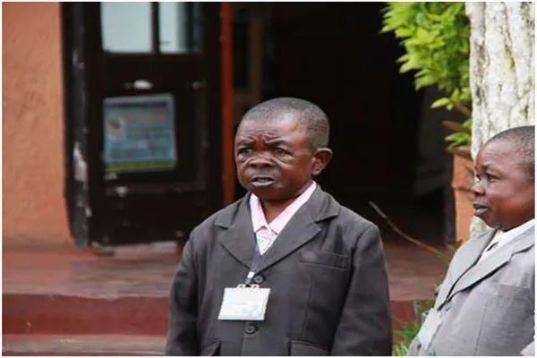 世界上最小的人排行榜前五名 因为疾病而变得矮小