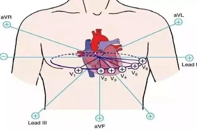 心电图导联位置图片