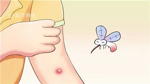 什么血型最招蚊子