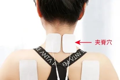 颈椎理疗仪贴片位置图