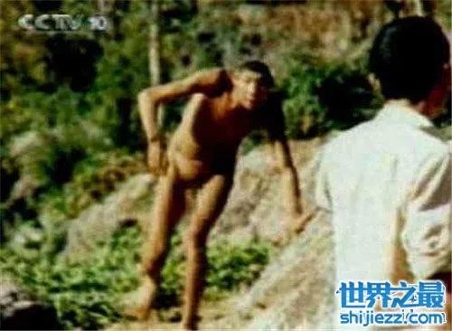 猴娃之谜的真相是什么 科学家表示竟然是这种病 