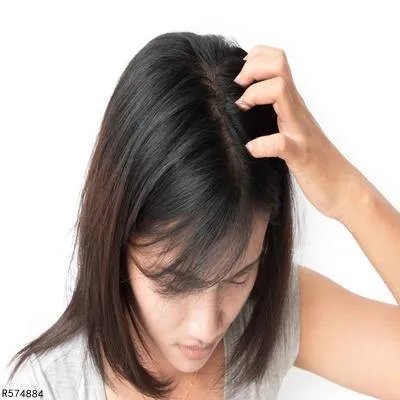 有什么方法可以快速的去除头皮屑