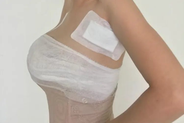 丰胸后的效果图片