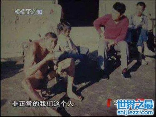 猴娃之谜的真相是什么 科学家表示竟然是这种病 