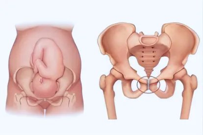孕妇耻骨部位图片