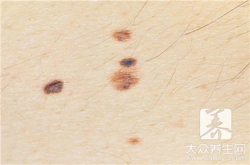 印堂有痣图解