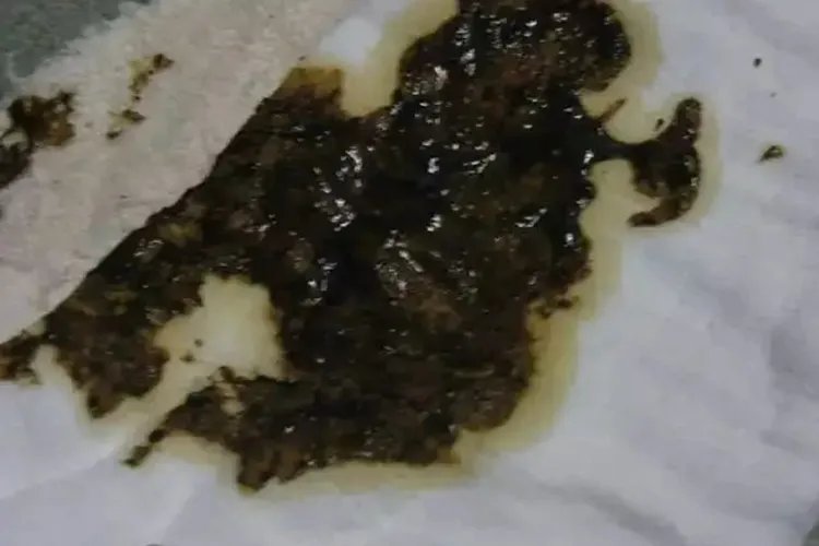 宝宝大便图片大全