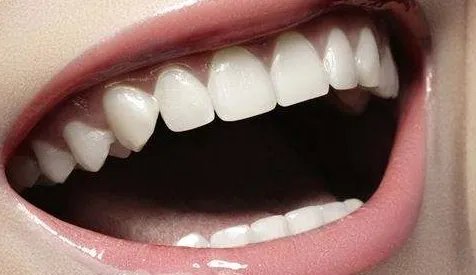 种植牙齿多少钱