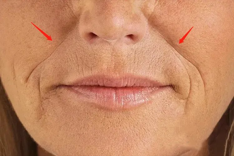 法令纹在哪个位置图