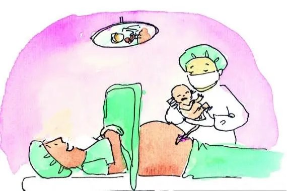 剖腹产的图片