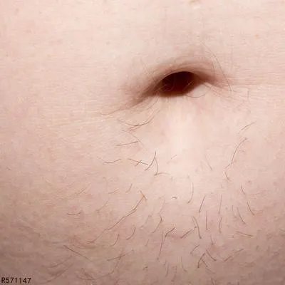 肚脐眼流水怎么回事