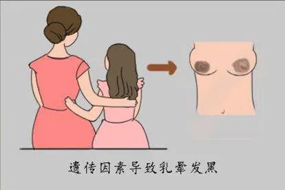 乳晕发黑图片