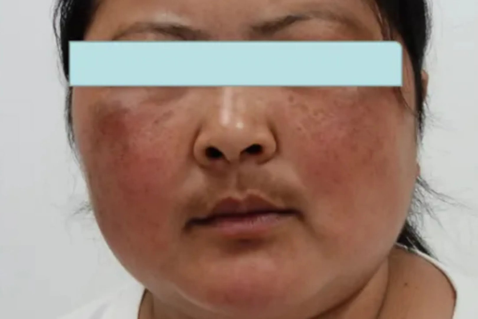 胖脸和满月脸的区别图片