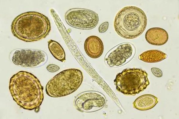 单纯疱疹病毒感染怎么检查出来