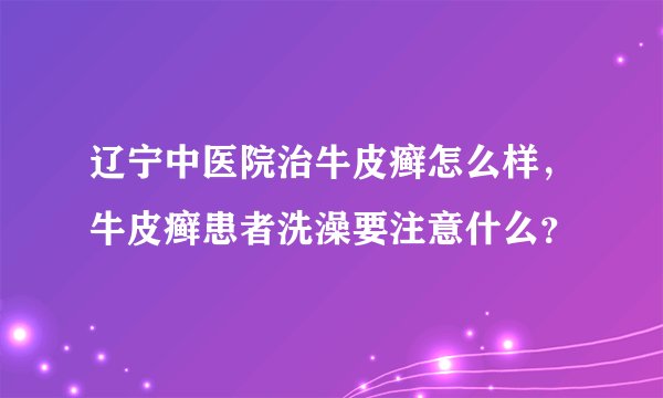 辽宁中医院治牛皮癣怎么样，牛皮癣患者洗澡要注意什么？