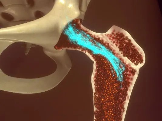 骨髓增生异常综合症的症状