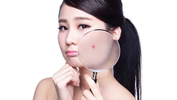 脸上长小痘痘怎么办