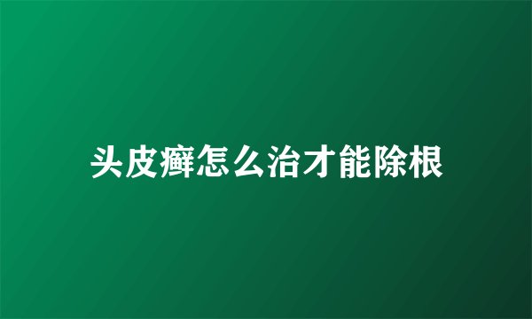 头皮癣怎么治才能除根
