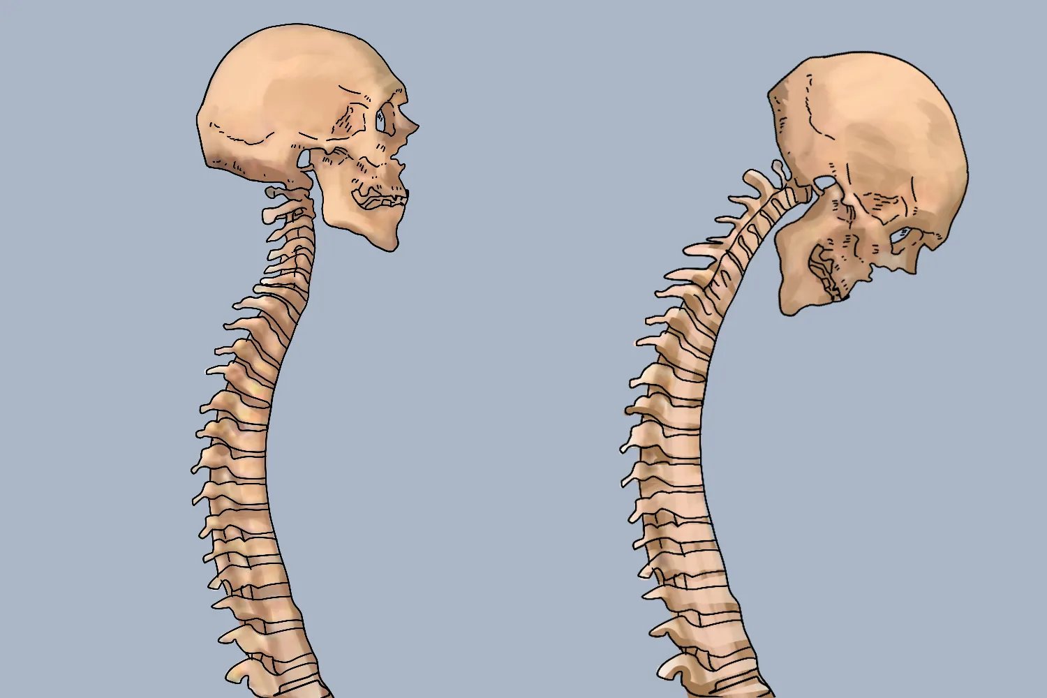 强直性脊柱炎有什么样的症状
