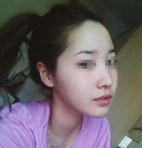 苏州整形医院哪家做面部吸脂好？