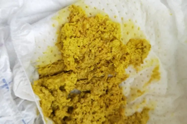 宝宝大便图片大全