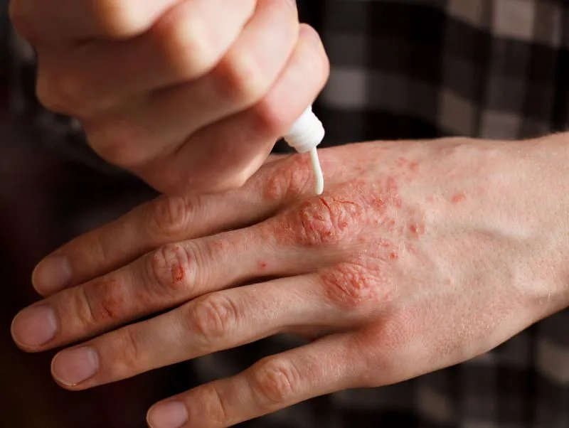 氨肽素是激素吗