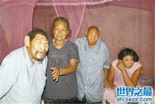 猴娃之谜的真相是什么 科学家表示竟然是这种病 