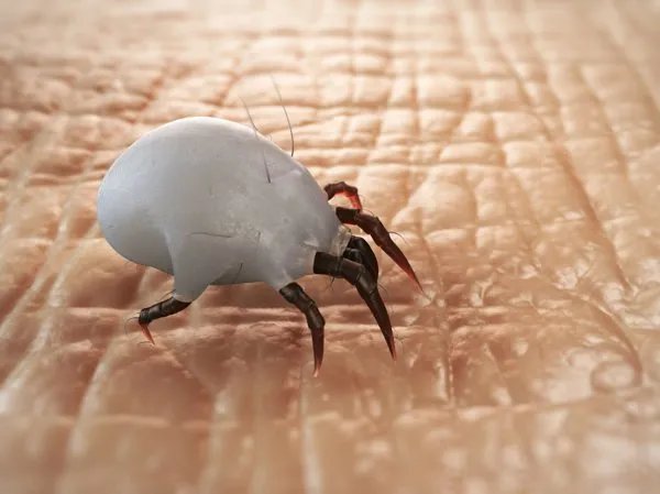 螨虫最怕什么东西