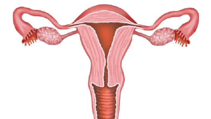 子宫囊肿是怎么形成的咋预防