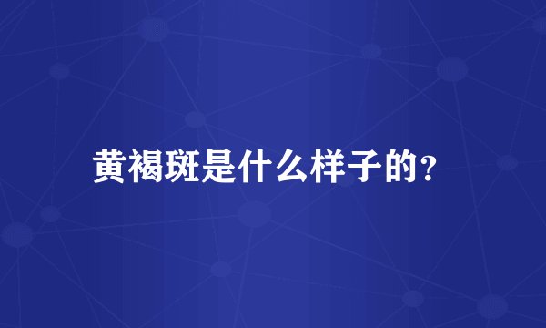 黄褐斑是什么样子的？