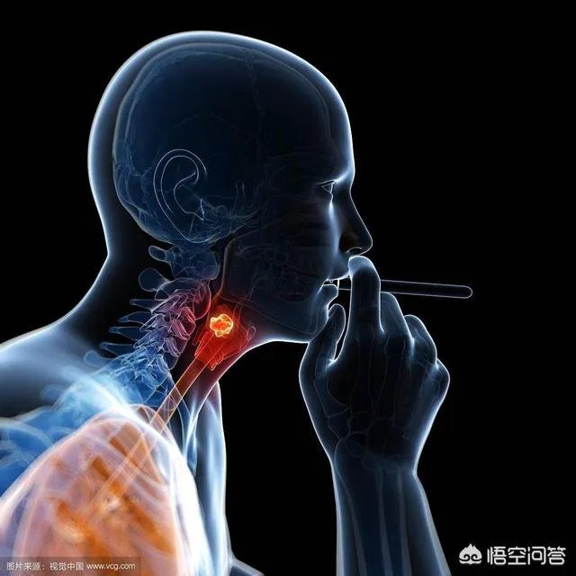 李咏到底是因为什么癌去世的?