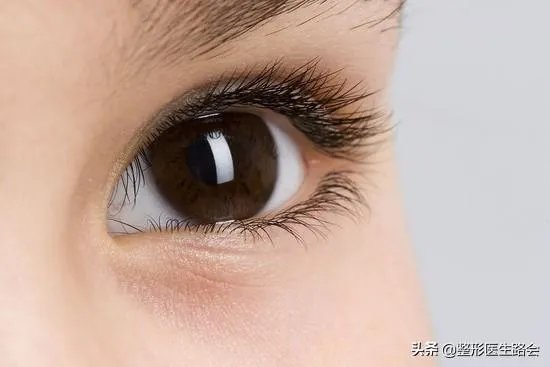 做双眼皮有几种方法？